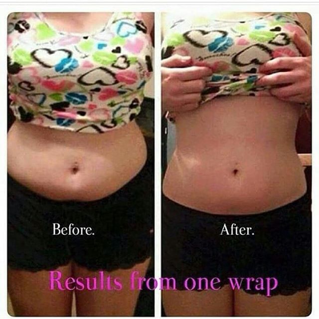 قبل و بعد استفاده از محصولات ضد سلولیت فوراور